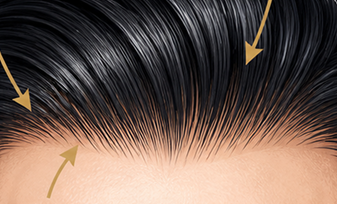Natural hairline — subtle irregularity
