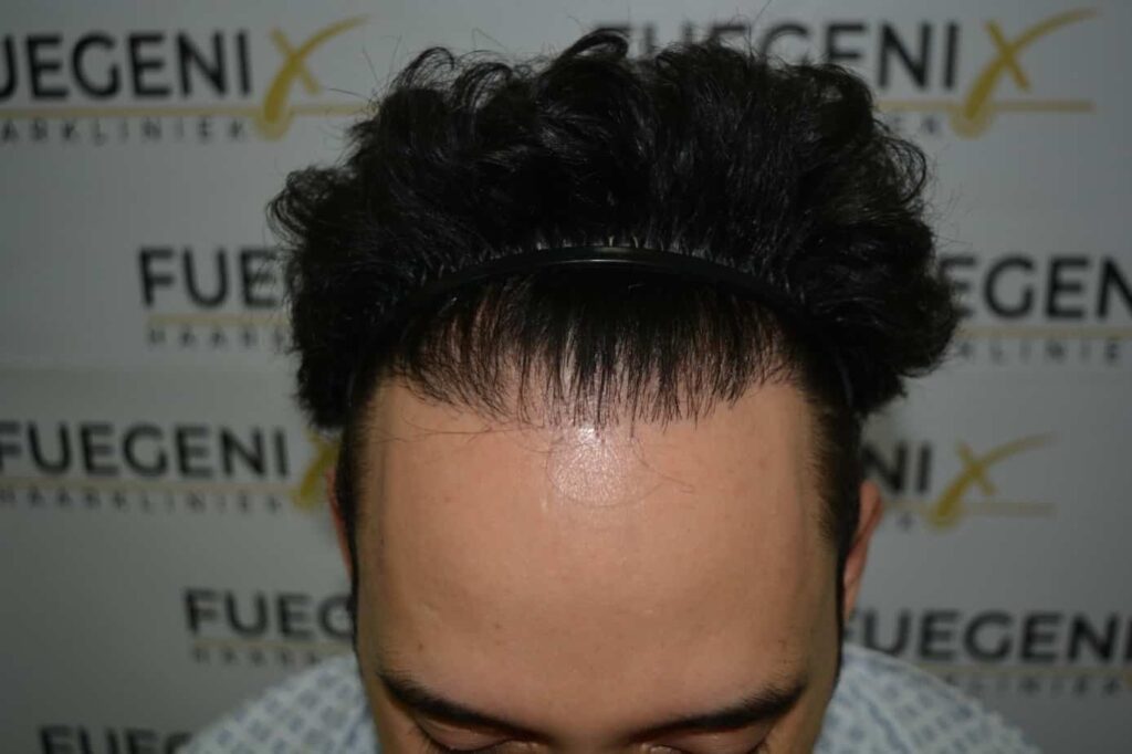 One Surgery Repair