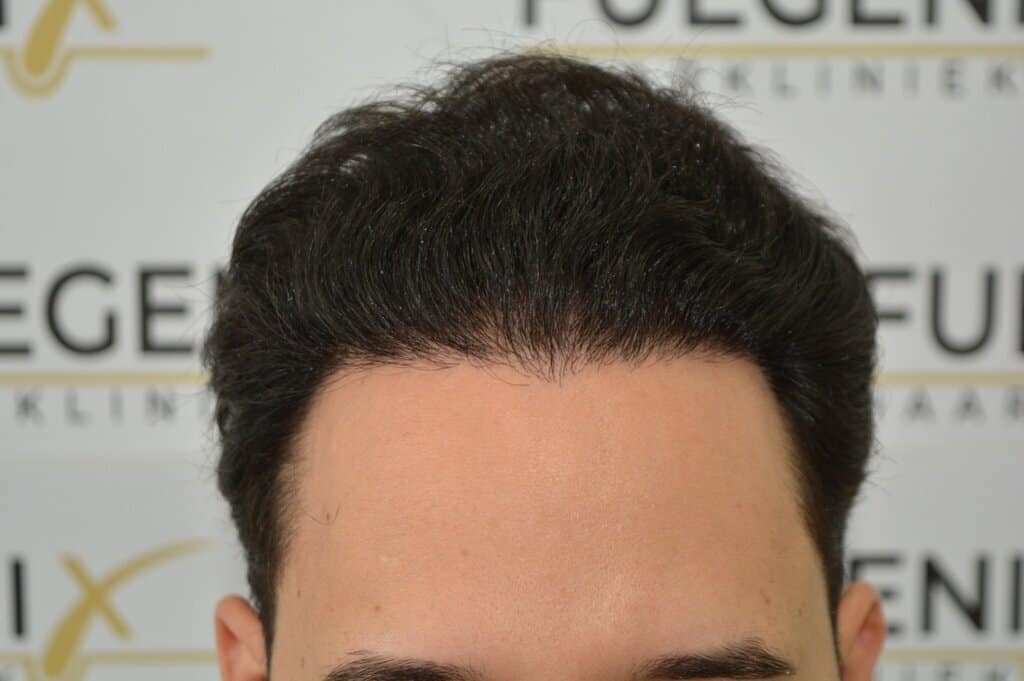 One Surgery Repair