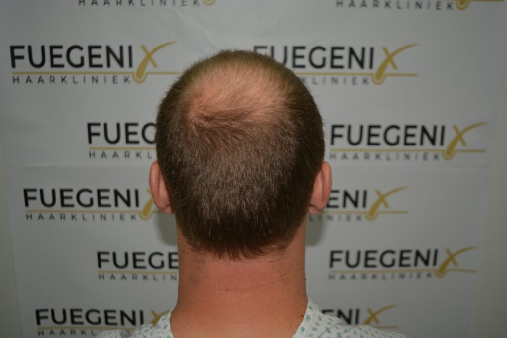 Next Level Crown Comb Through