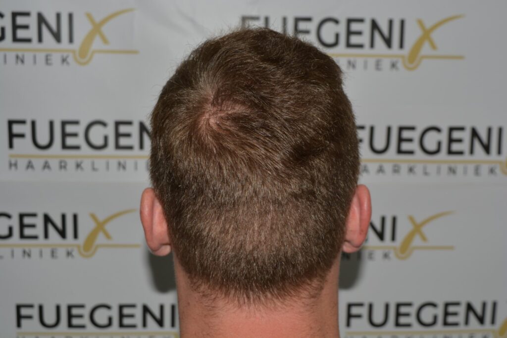 Next Level Crown Comb Through