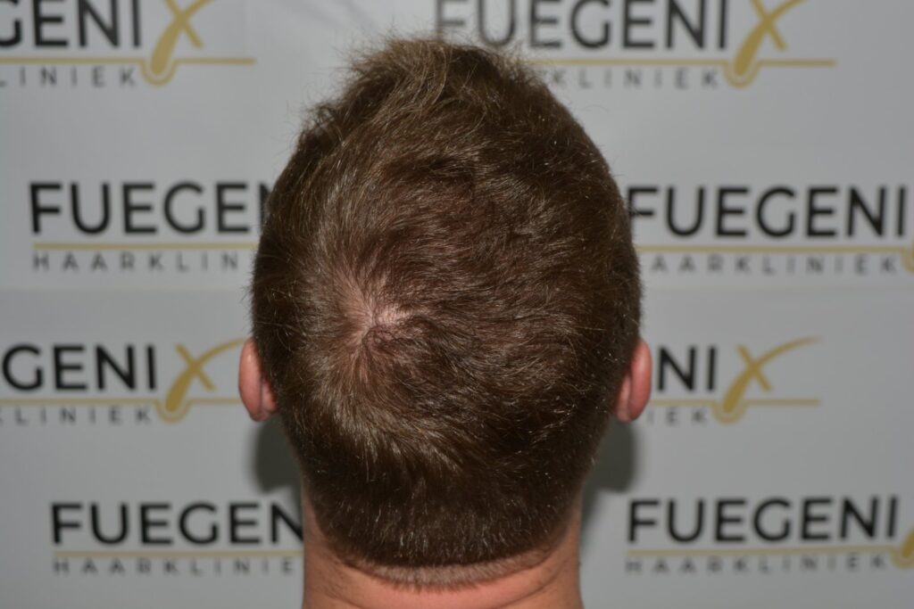 Next Level Crown Comb Through