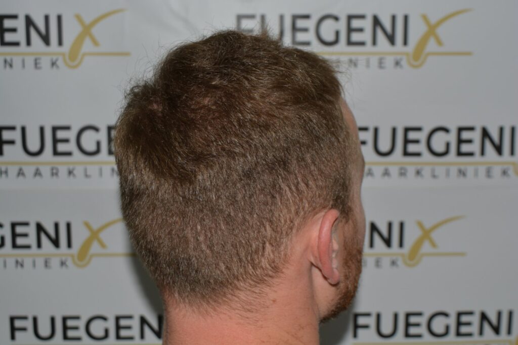 Next Level Crown Comb Through