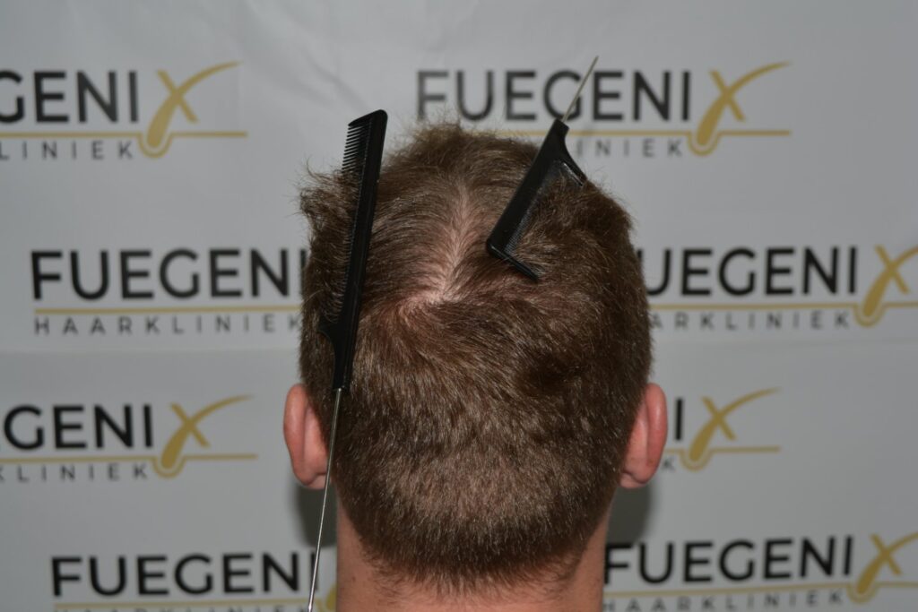 Next Level Crown Comb Through