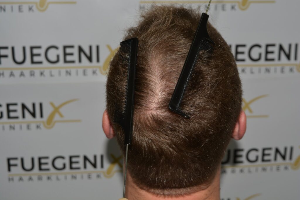 Next Level Crown Comb Through