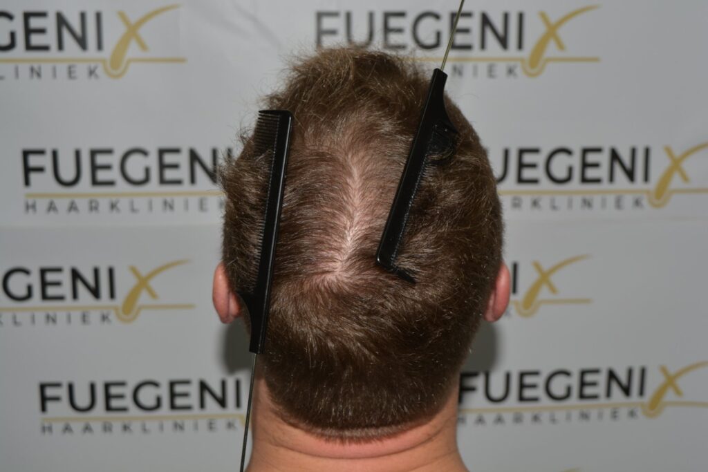 Next Level Crown Comb Through