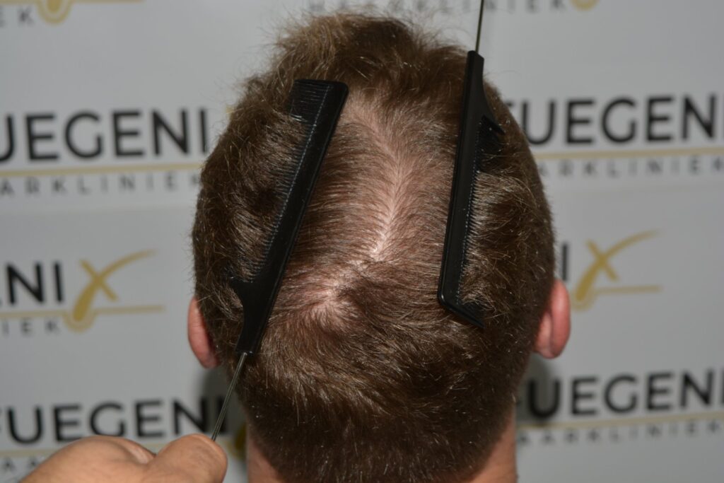 Next Level Crown Comb Through