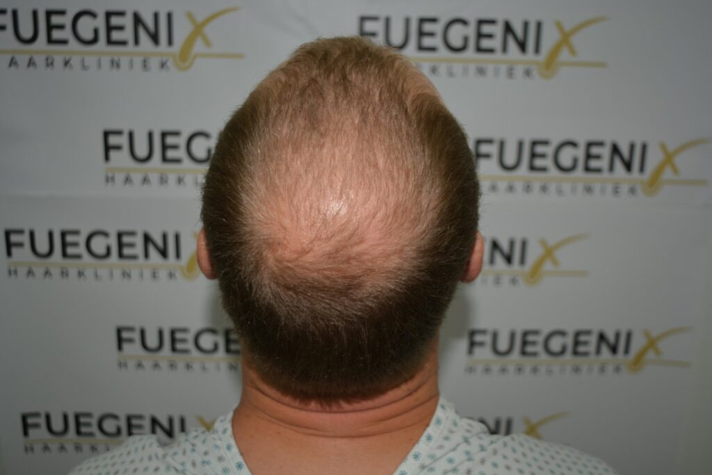 Next Level Crown Comb Through