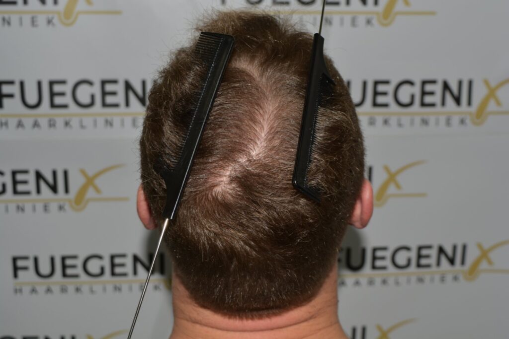 Next Level Crown Comb Through