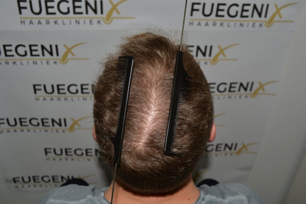 Next Level Crown Comb Through