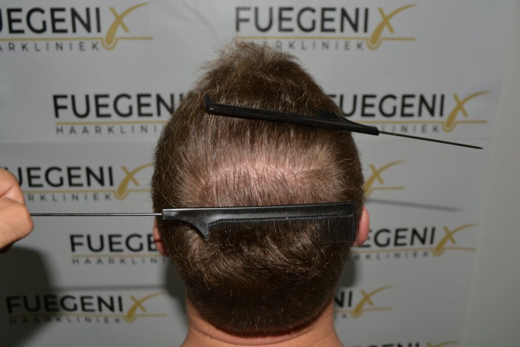 Next Level Crown Comb Through