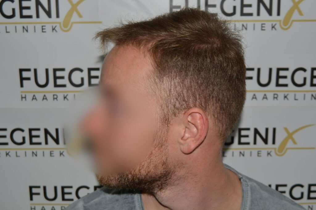 Next Level Crown Comb Through