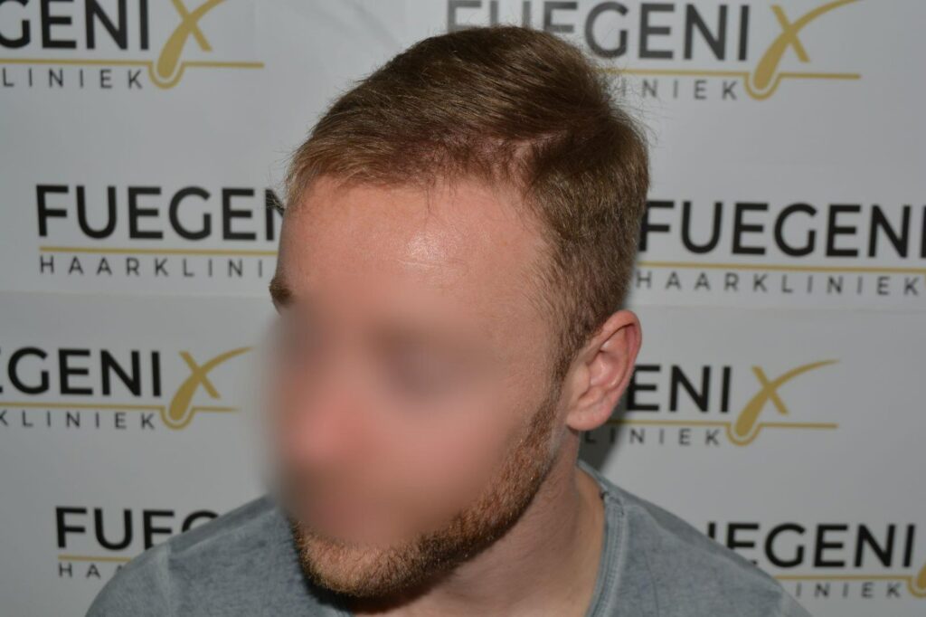 Next Level Crown Comb Through
