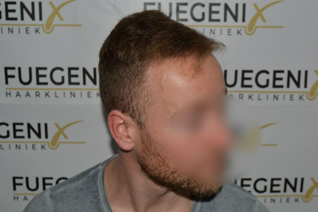 Next Level Crown Comb Through