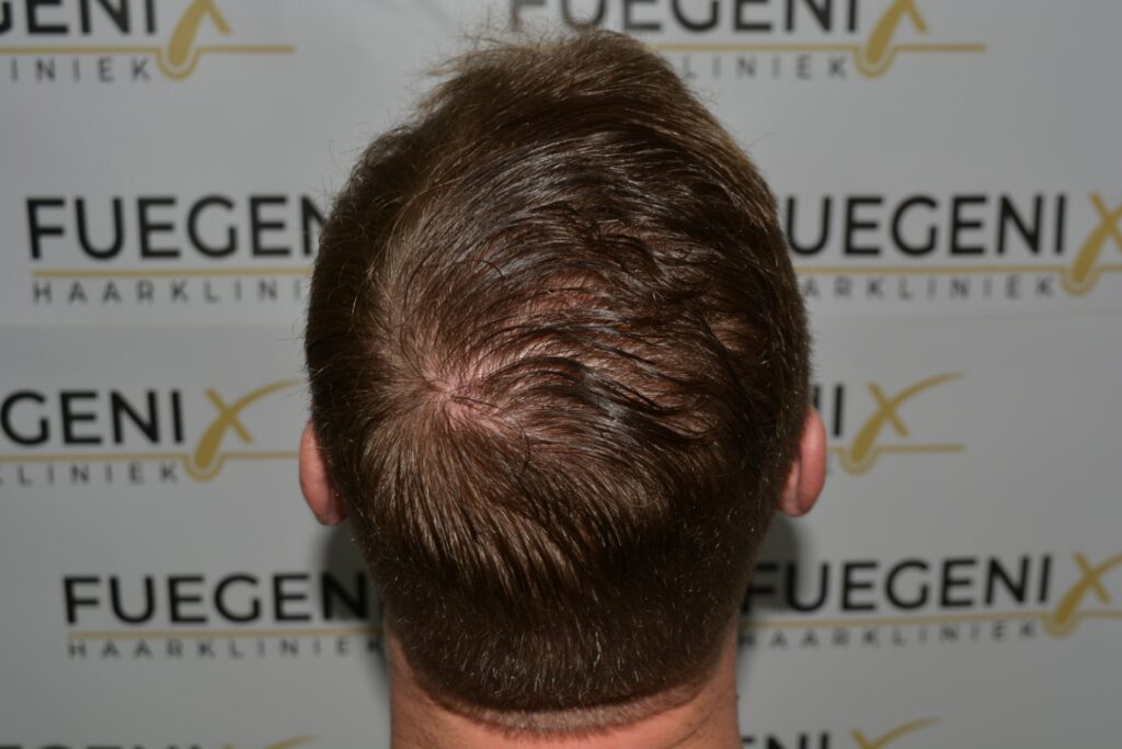 Next Level Crown Comb Through