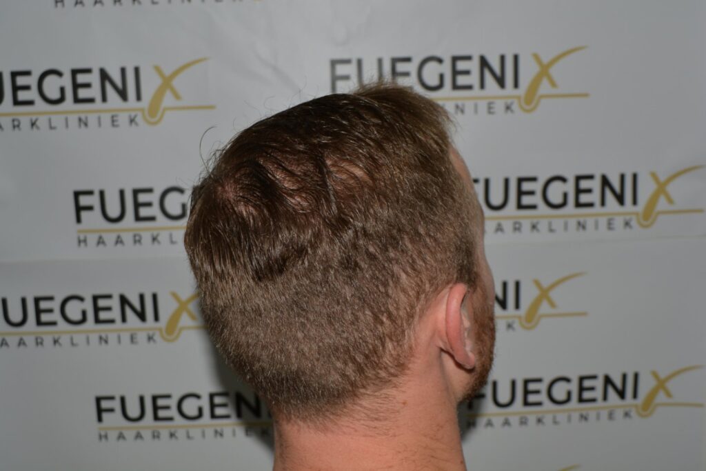 Next Level Crown Comb Through