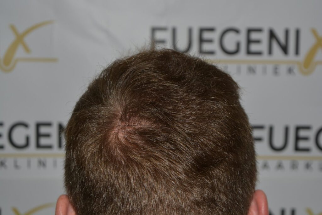 Next Level Crown Comb Through