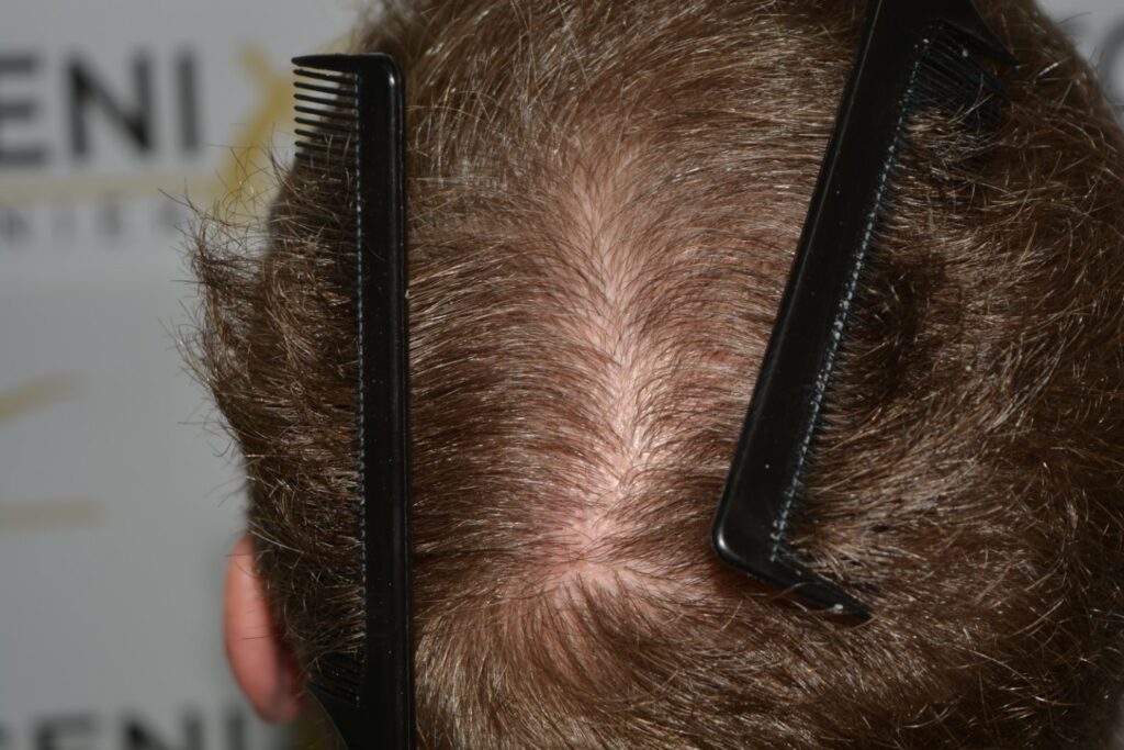 Next Level Crown Comb Through