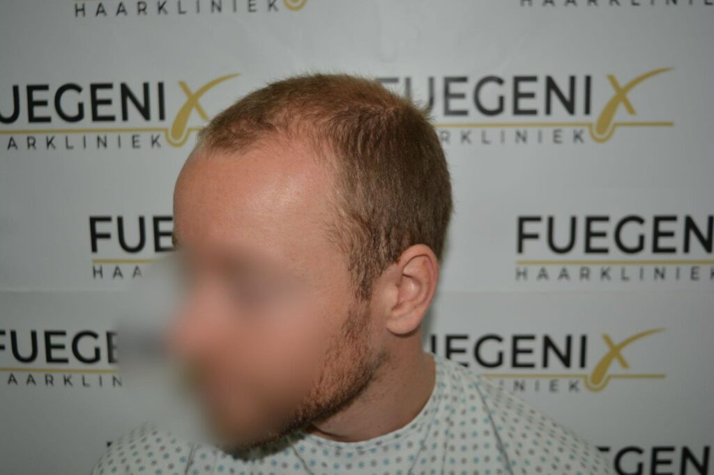 Next Level Crown Comb Through
