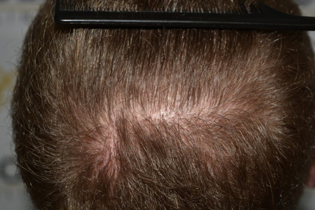 Next Level Crown Comb Through