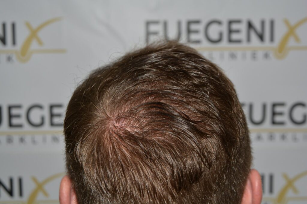 Next Level Crown Comb Through
