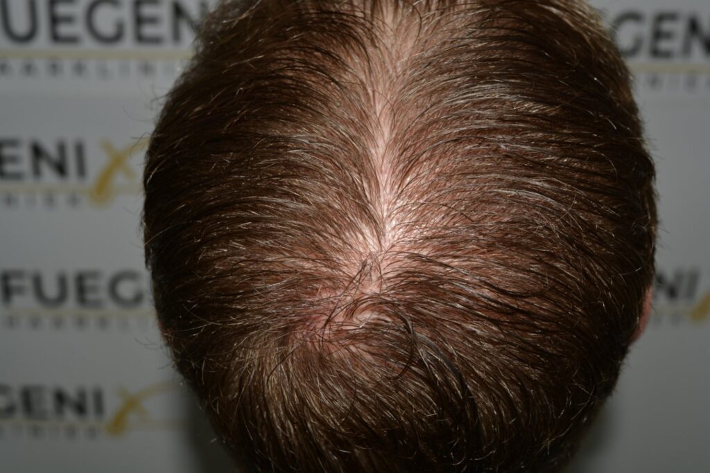 Next Level Crown Comb Through