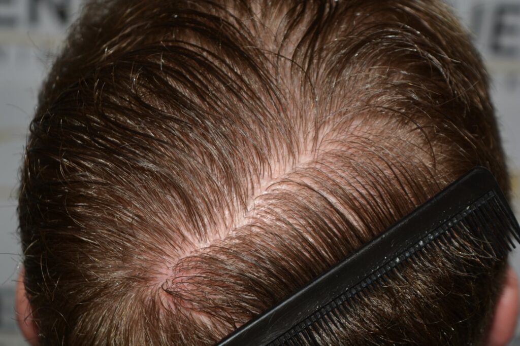 Next Level Crown Comb Through