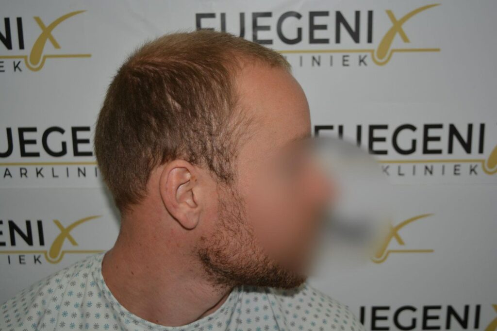 Next Level Crown Comb Through