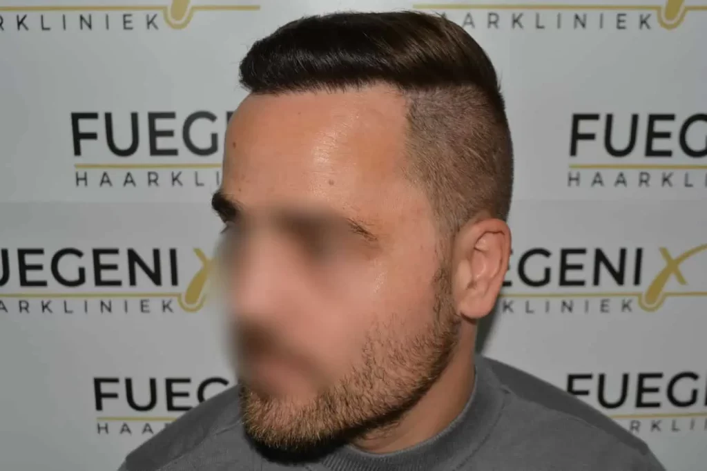 The Hairline That You Dream Of