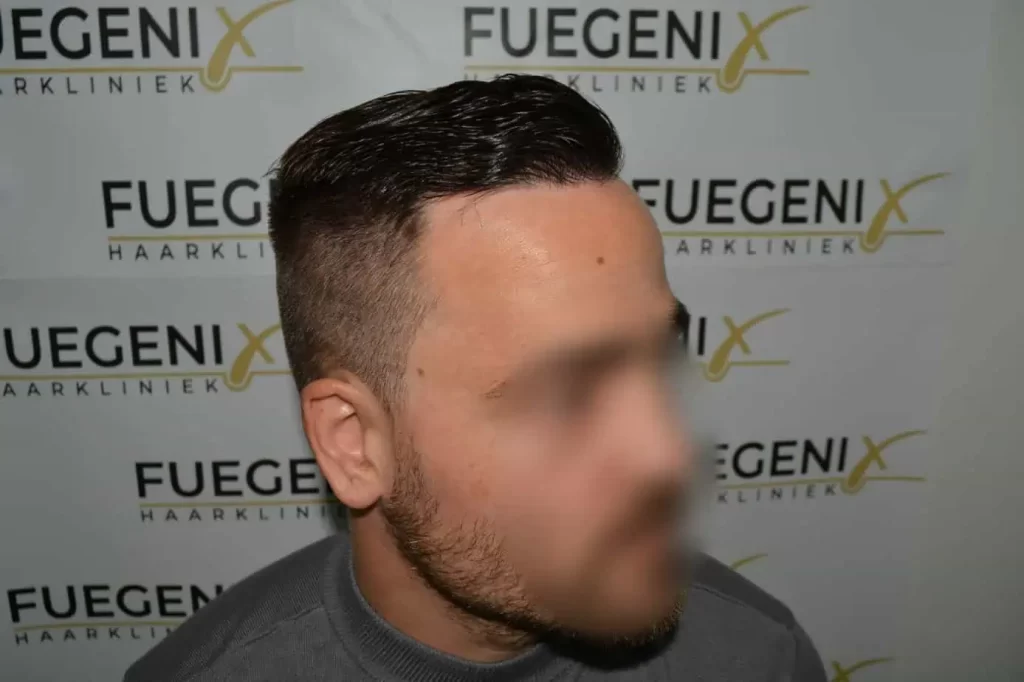 The Hairline That You Dream Of