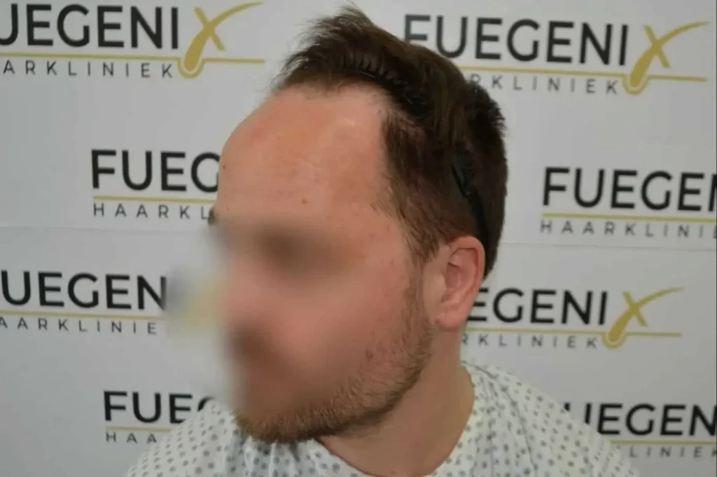 The Hairline That You Dream Of