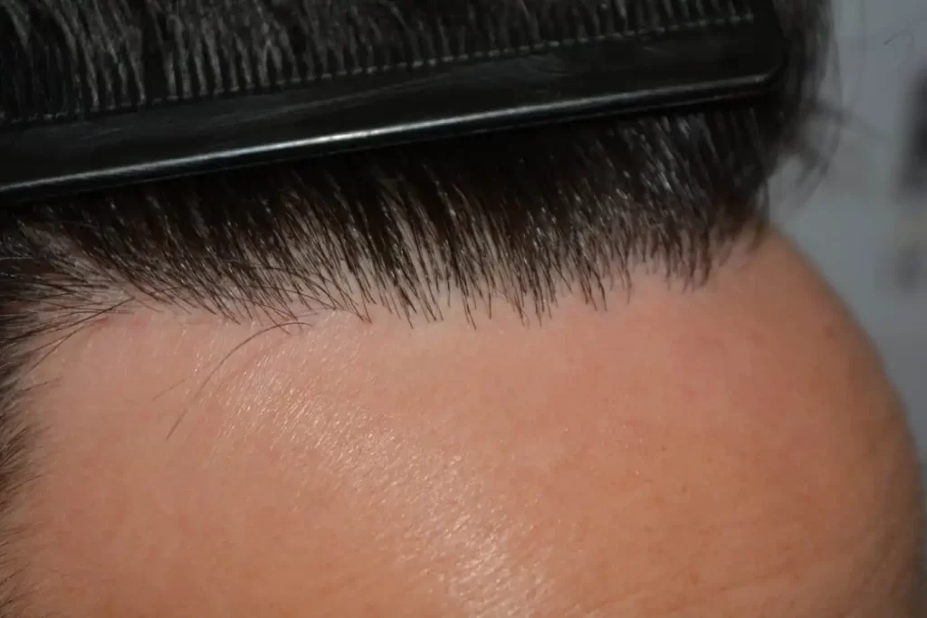 The Hairline That You Dream Of
