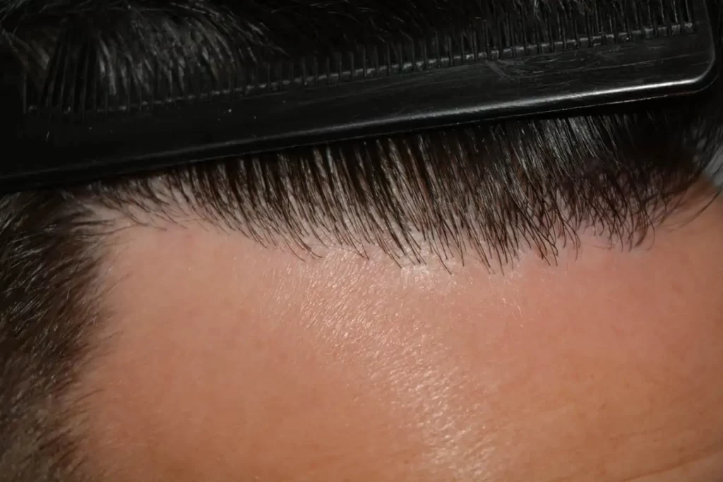 The Hairline That You Dream Of