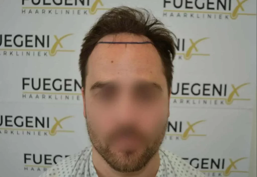The Hairline That You Dream Of
