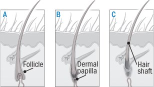 Diagram of the life cycle of a hair, showing the anagen, catagen and telogen phases