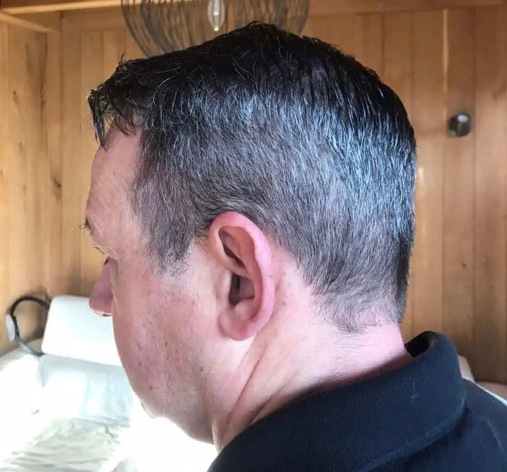 Salt And Pepper Hairline