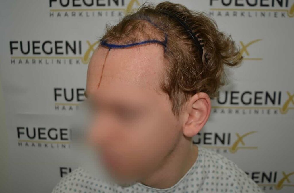 Soft Dense Hairline