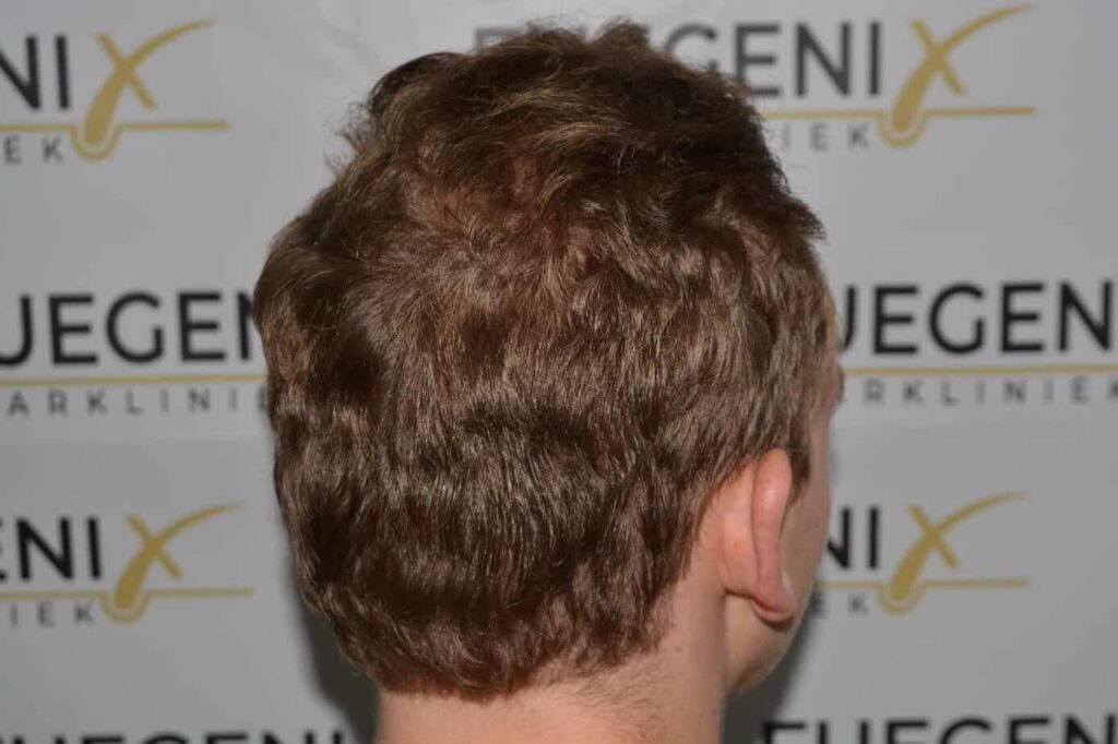 Soft Dense Hairline