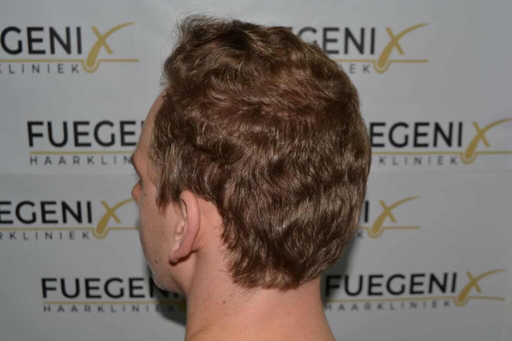 Soft Dense Hairline