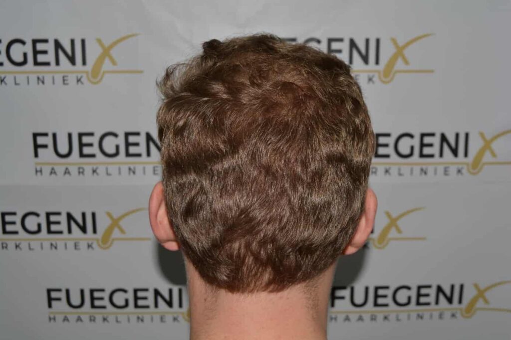 Soft Dense Hairline