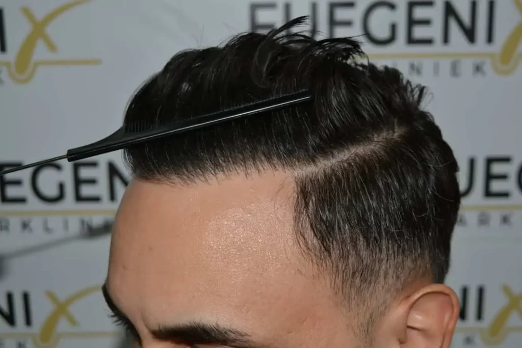 The Bollywood Hairline