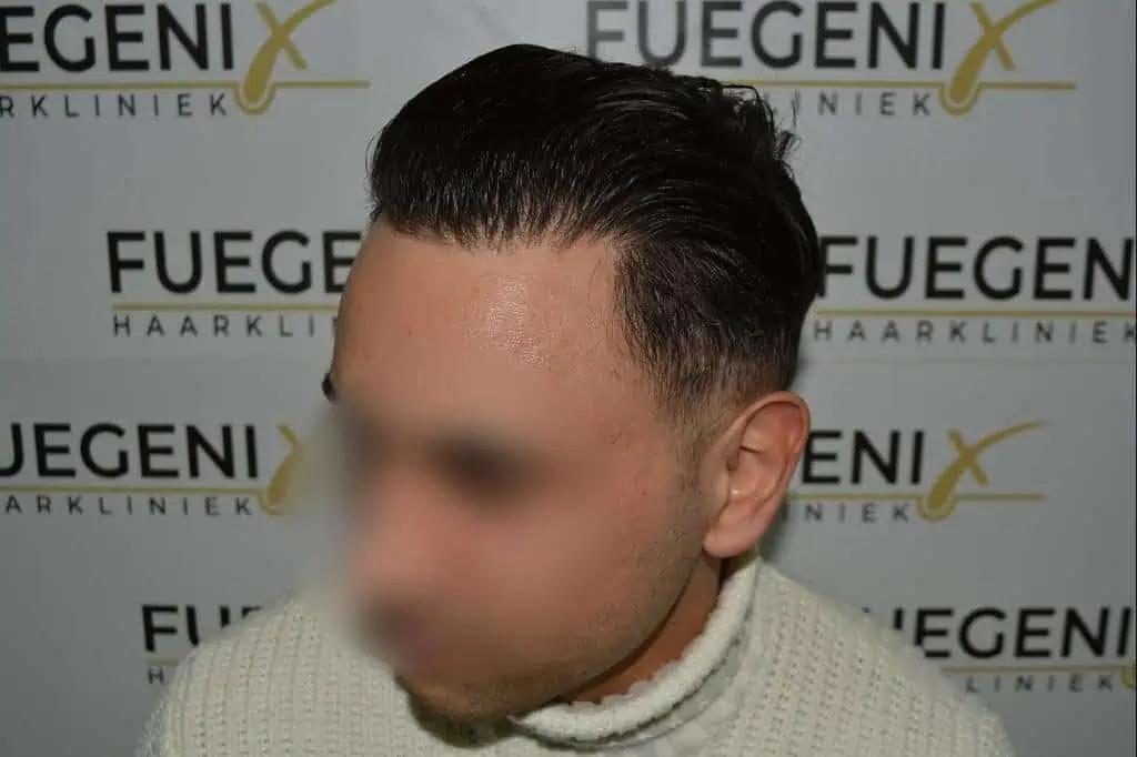 The Bollywood Hairline