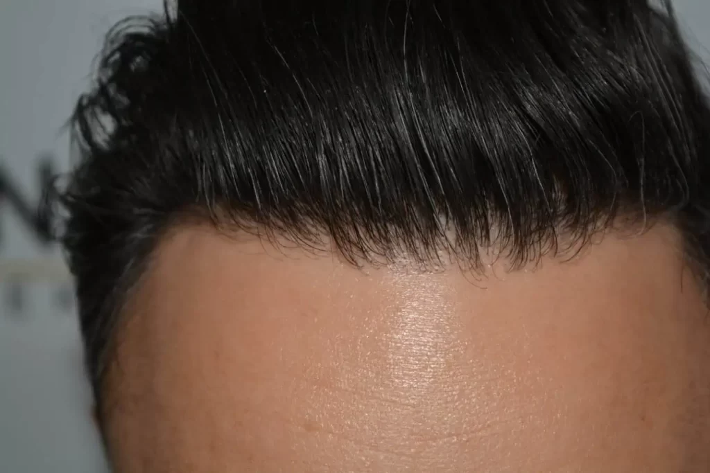 The Bollywood Hairline