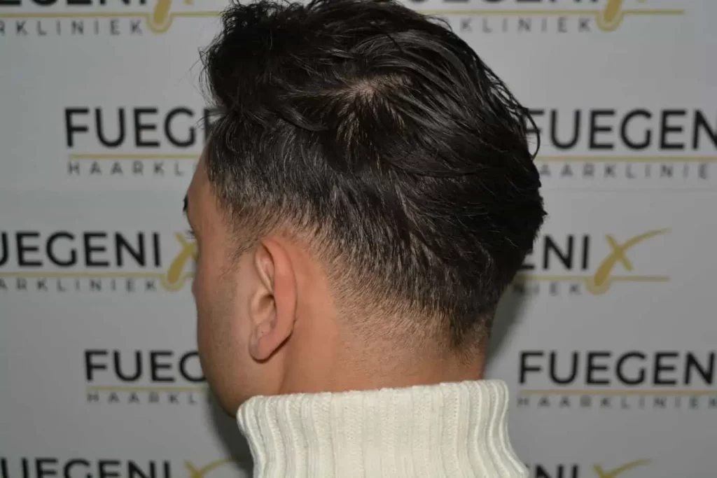 The Bollywood Hairline