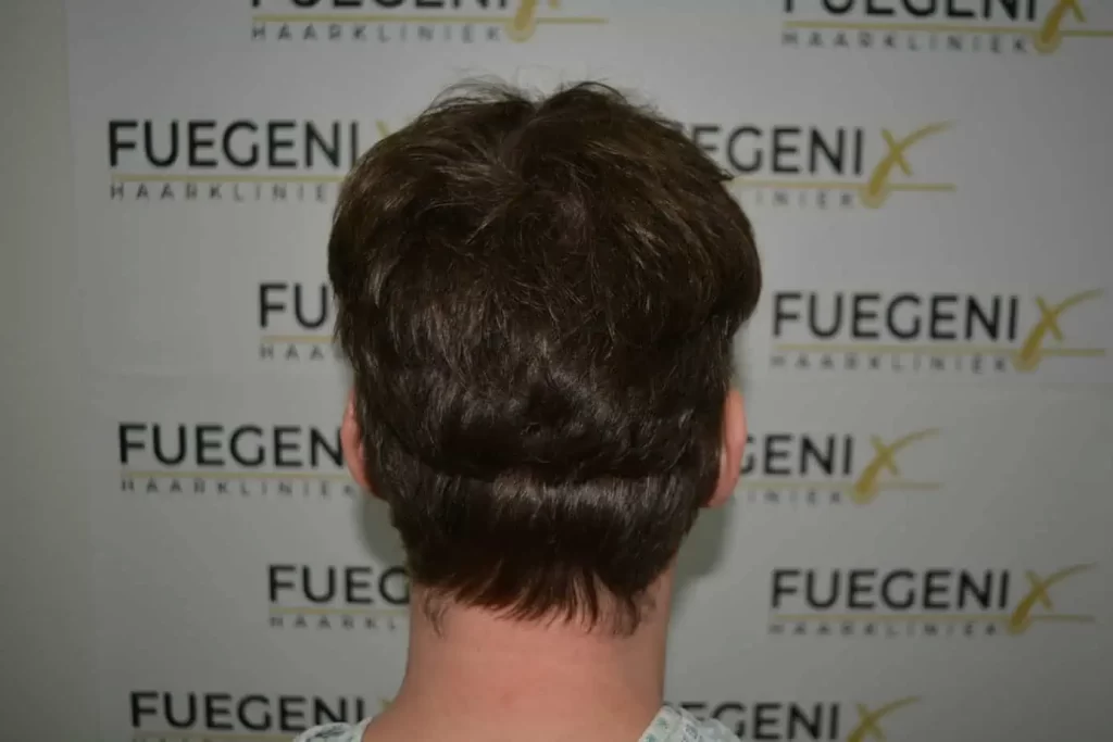 The Henry Cavill Hairline
