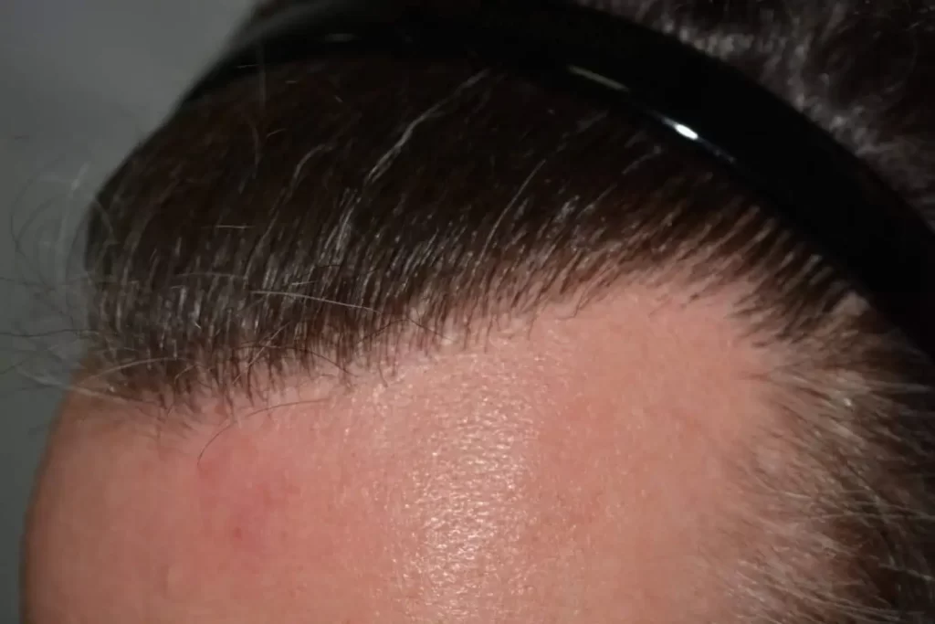 The Henry Cavill Hairline