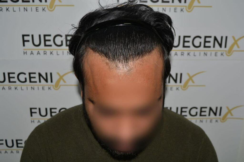 Insecure To Confident