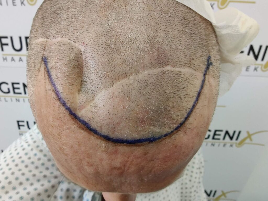 Scars All In One