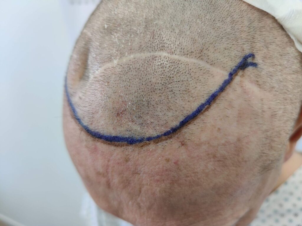 Scars All In One
