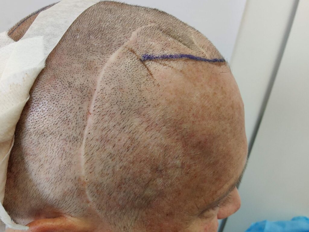 Scars All In One